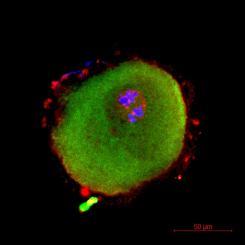 Human oocyte was stained for defective proteins to gain insights into the maturation defects.